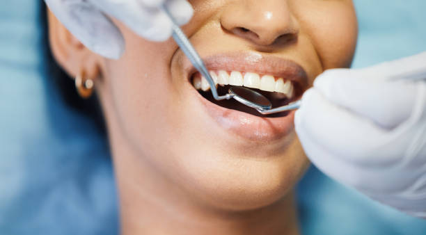 Best Emergency Cosmetic Dentistry (e.g., broken veneers) in Linden, AZ
