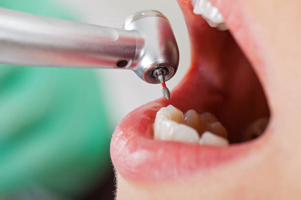 Best Dental Abscess Treatment in Linden, AZ